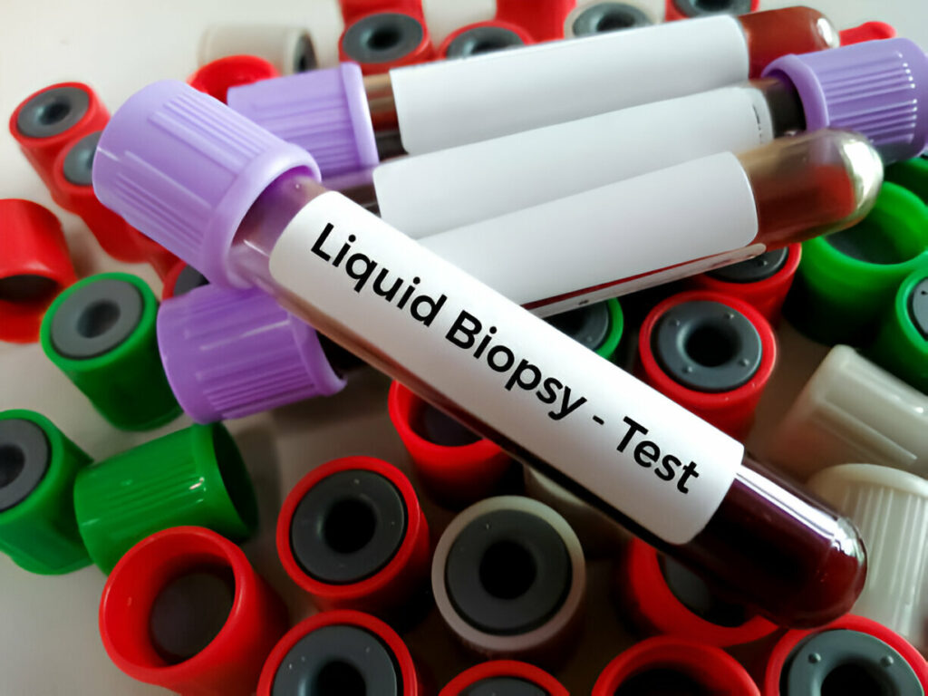 Liquid Biapsy